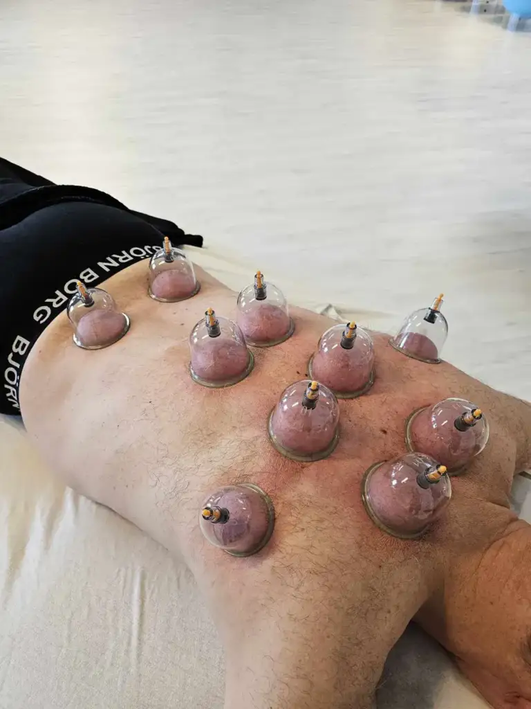 Kopning som del af behandlingen